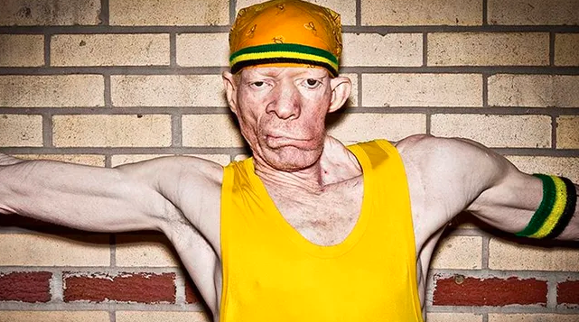 Yellowman : la force imparable du reggae et du dancehall